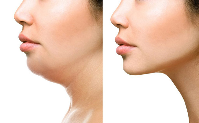 cách gảim béo cổ tại nhà hiệu quả